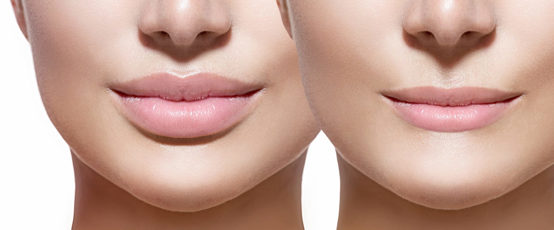 Are lip fillers safe?
