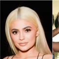Lip Fillers at 16: Is It Safe and What Are the Risks?