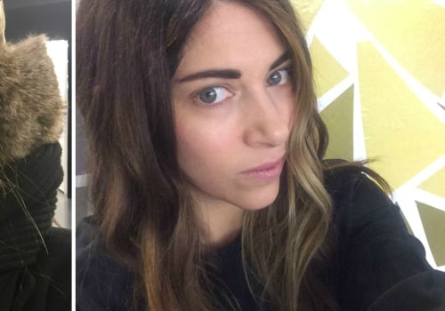 Do Lip Fillers Damage Your Lips? A Comprehensive Guide