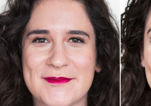 How Lip Fillers Can Transform Your Face