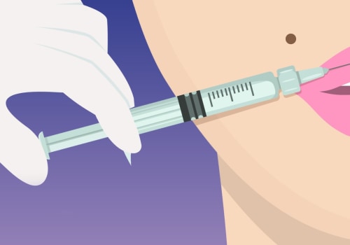 The Art of Lip Augmentation with Fillers