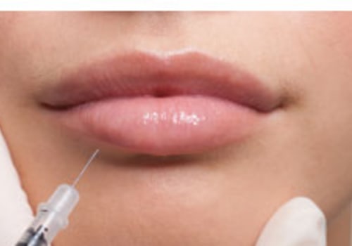 GATTONI Medical Aesthetics & Wellness Helps Achieve Natural Fuller Lips